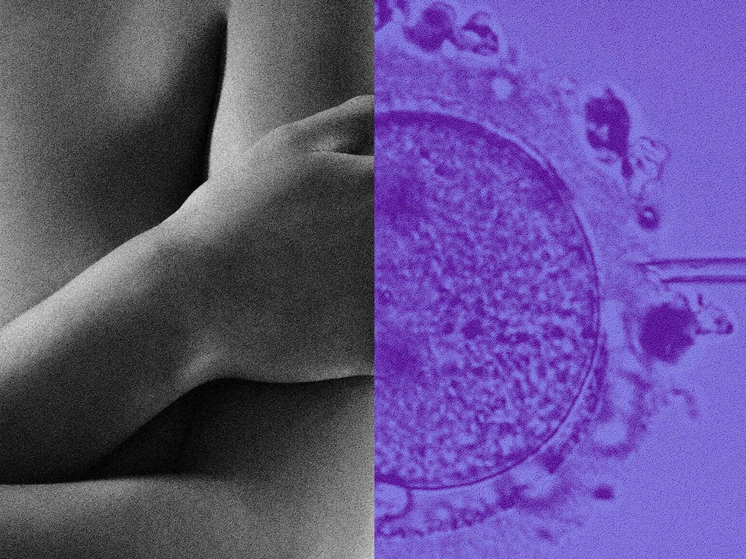 Content Creator Bridget Bahl Started IVF Treatment&-and Came Away With a Cancer Diagnosis